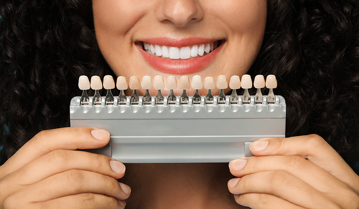 What to Expect During a Professional Teeth Whitening Treatment